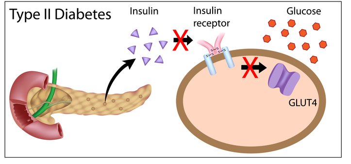 如果你知道生酮对糖尿病有帮助，但你对胰岛素的了解有多少呢